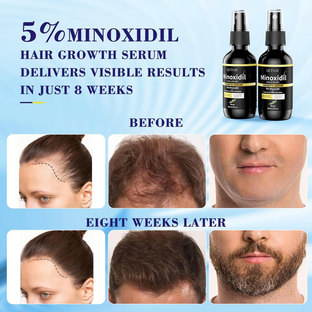 5% minoxidil spray held in hand for scale, showing compact bottle for travel convenience