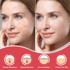 AcneGo close-up texture of thin hydrocolloid patch for discreet wear