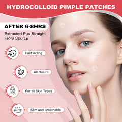 AcneGo patch on pillow demonstrating overnight adhesion and protection