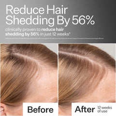 ACT+ ACRE dropper dispensing serum showing precise application and control