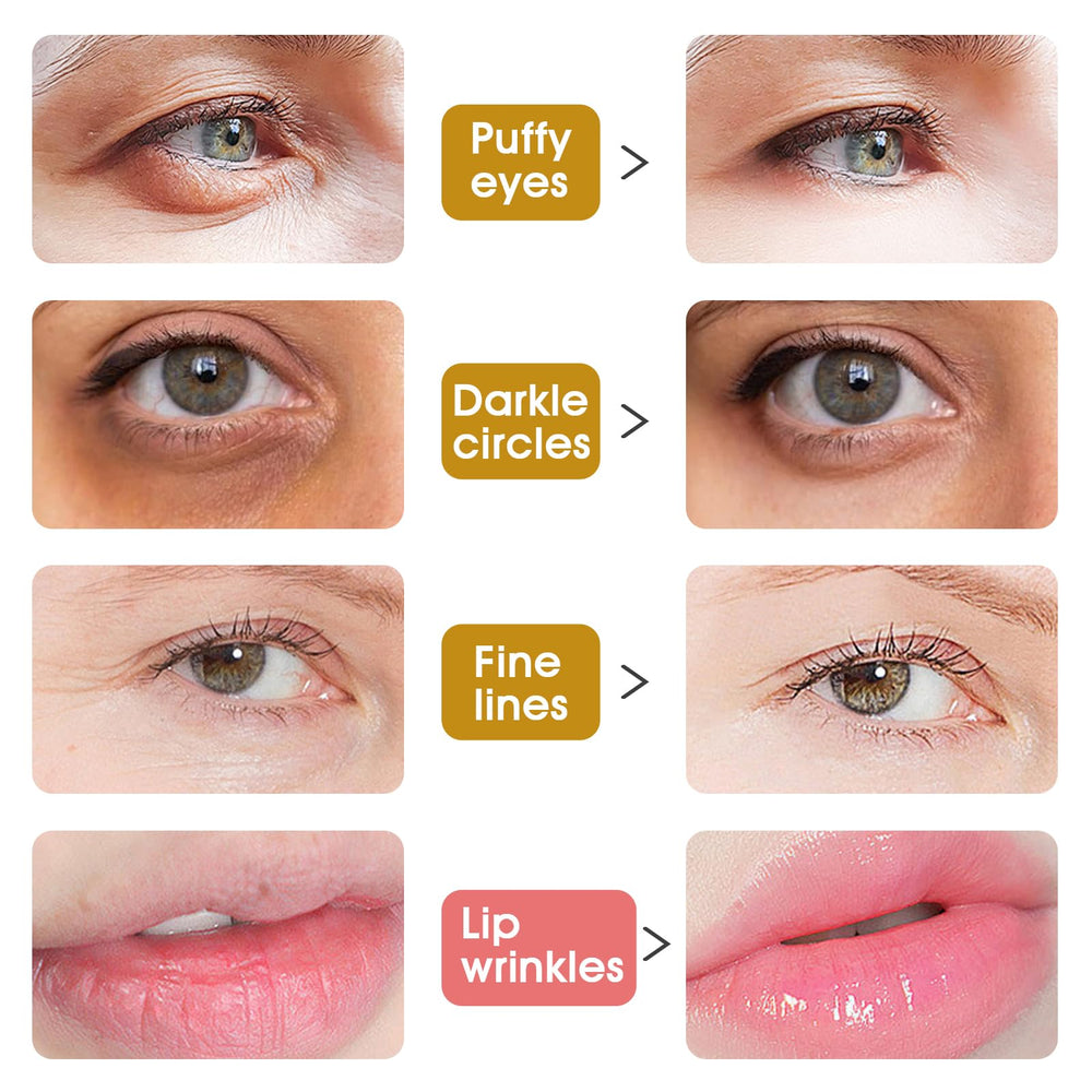 Adofect laid-out contents with 20 eye pairs and 20 lip masks for convenience
