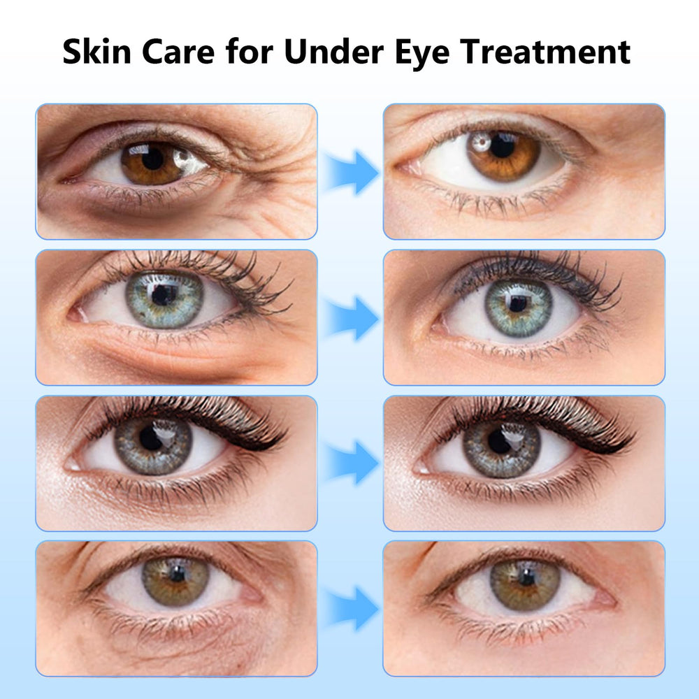 Adofect patch applied under eye illustrating comfortable, contour fit