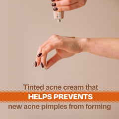Adult Acnomel tube with cap open illustrating easy application benefit