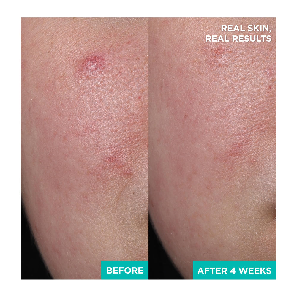 AESTURA A-CICA365 being smoothed on hand demonstrating quick absorption benefit