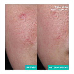 AESTURA A-CICA365 being smoothed on hand demonstrating quick absorption benefit