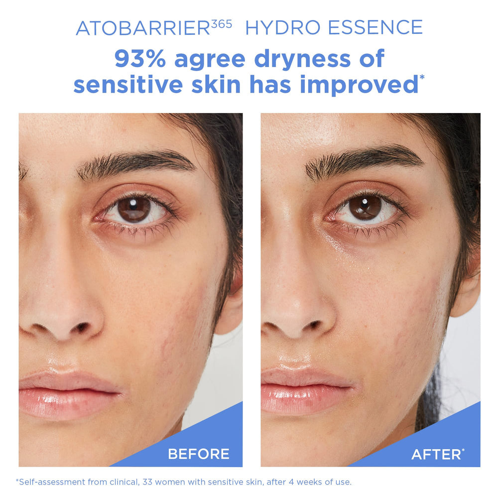 AESTURA essence being patted into skin to show hydration and quick sink-in
