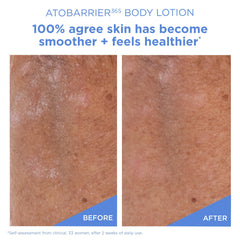 AESTURA ingredient close-up with glycerin and panthenol conveying intense hydration