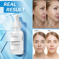 AFCRYIYE before and after illustration showing reduced pores and improved tone benefit