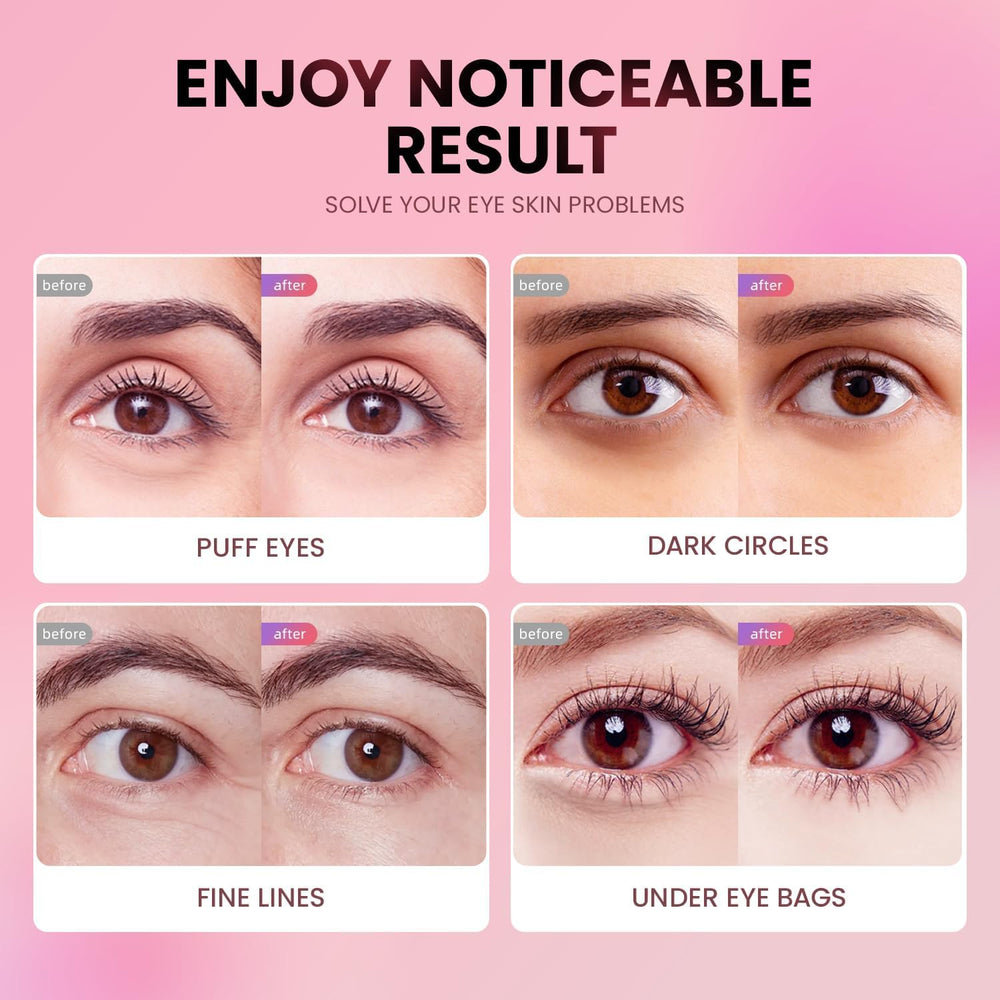 AILEORY ingredient collage showing collagen and hyaluronic benefits