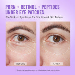 AILEORY patch on hand comparing size and coverage benefits