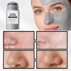Generic Alaska Volcano stick in a travel kit for on-the-go pore care