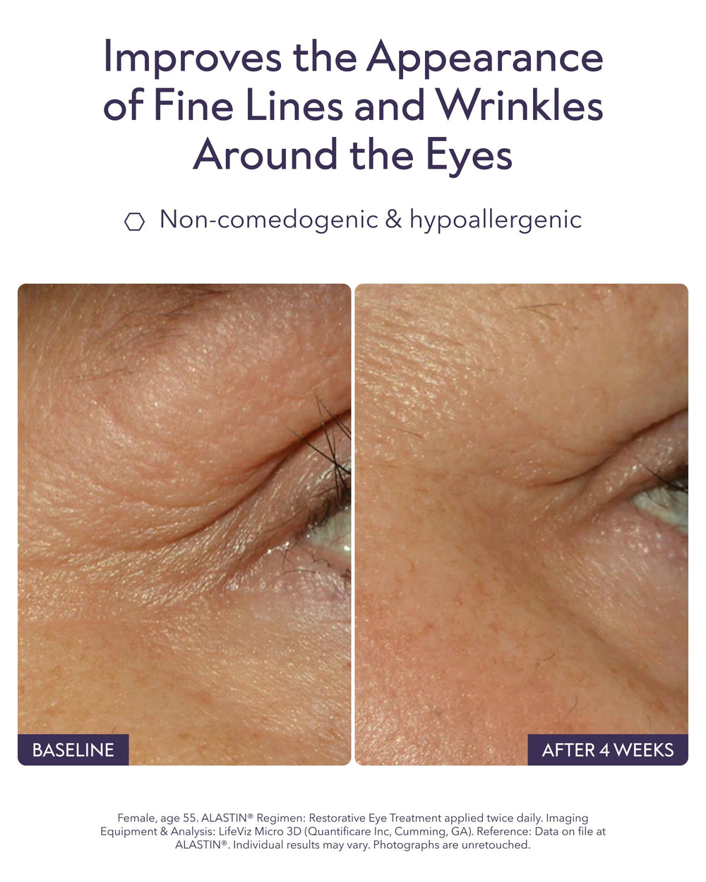 ALASTIN Skincare cream texture close-up emphasizing smooth hydration