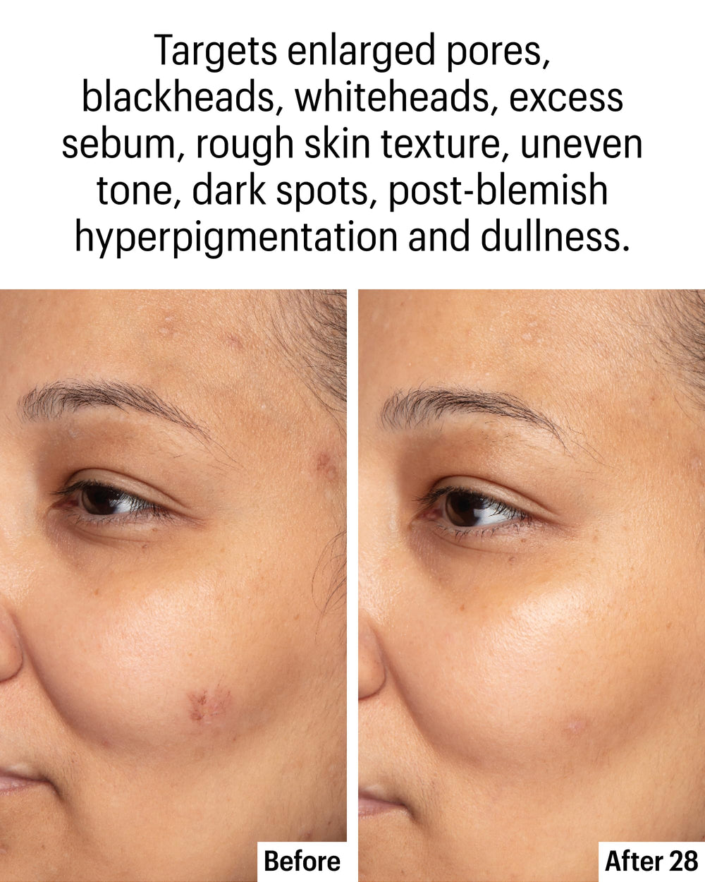 Allies of Skin active ingredient close-up highlighting azelaic and kojic acids