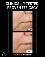 Allies of Skin ingredients visual highlighting ferulic and teprenone antioxidant protection