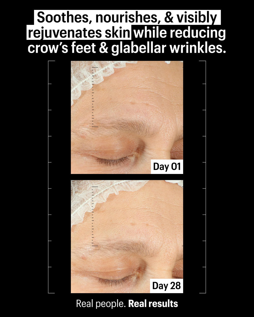 Allies of Skin texture close-up with a droplet highlighting fast absorption