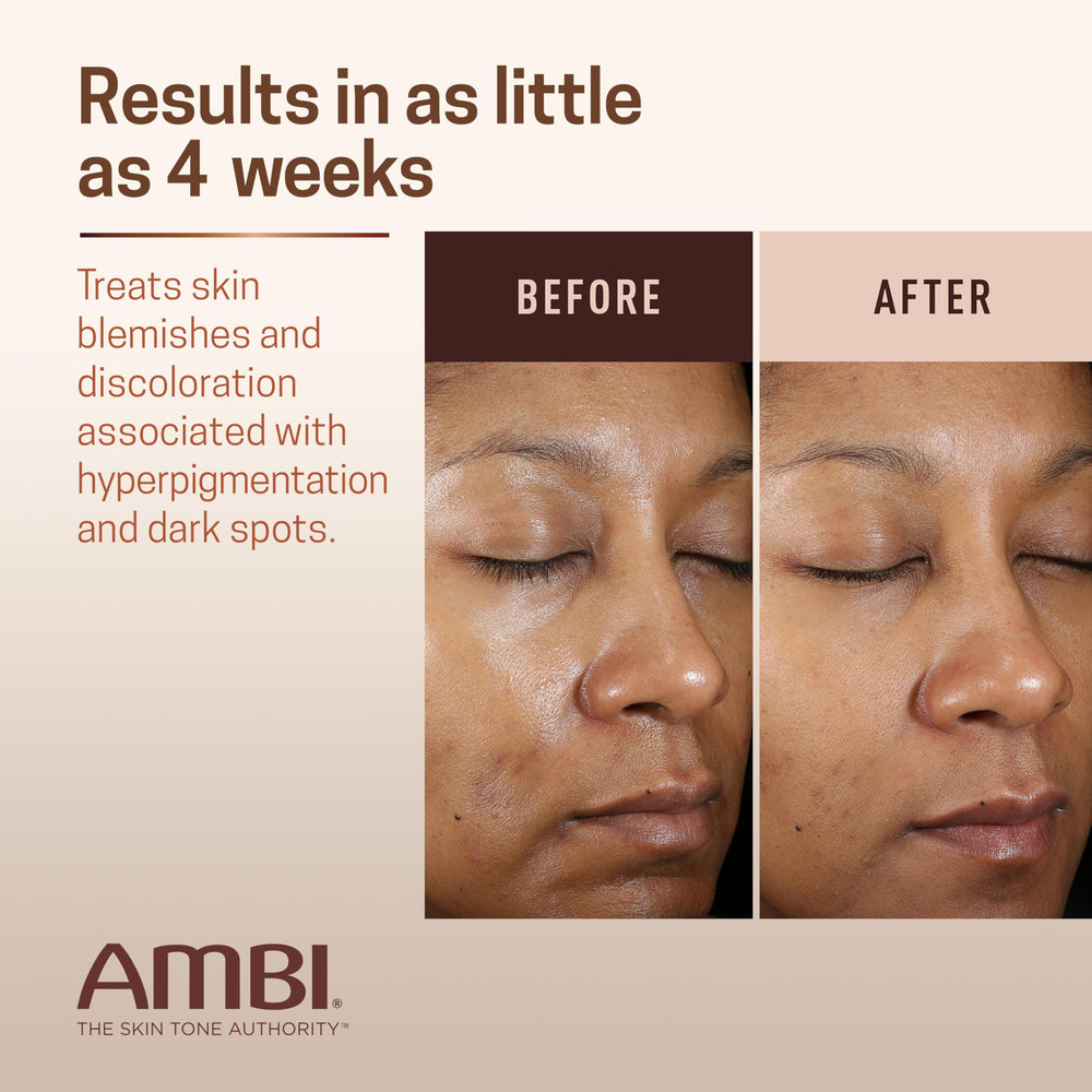 Ambi application on face demonstrating targeted spot treatment and improved appearance