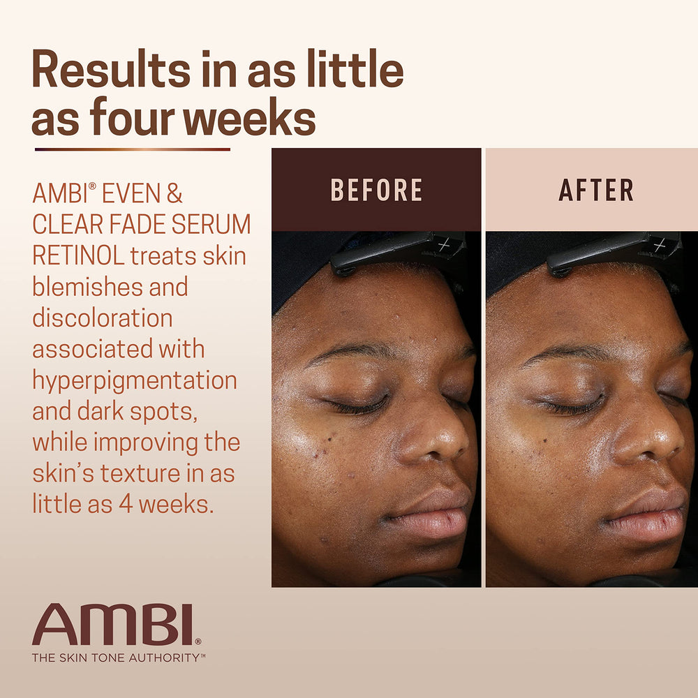 Ambi close-up of encapsulated retinol technology supporting smoothing