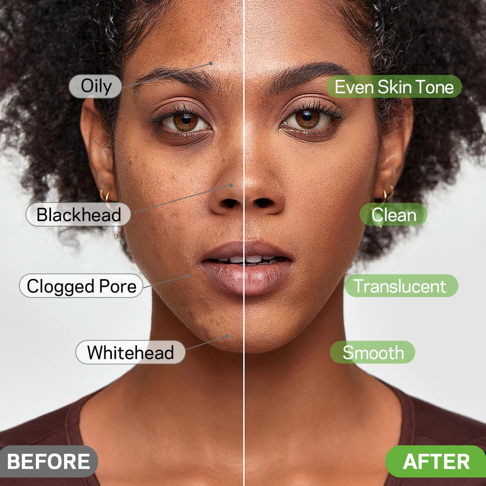 AMOADO nose area before and after use demonstrating clearer pores