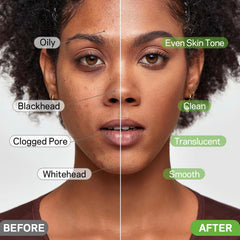 AMOADO nose area before and after use demonstrating clearer pores
