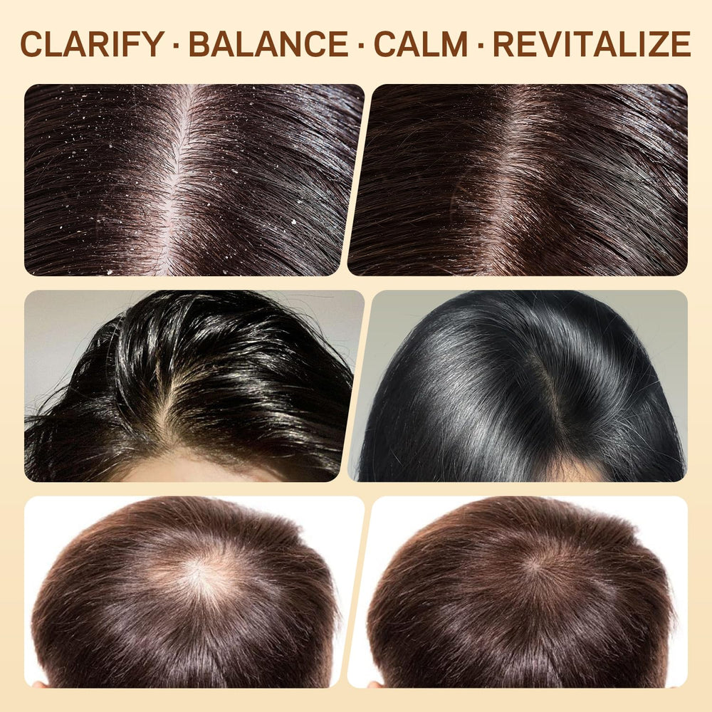 AMOADO scalp massage in shower demonstrating application for buildup removal