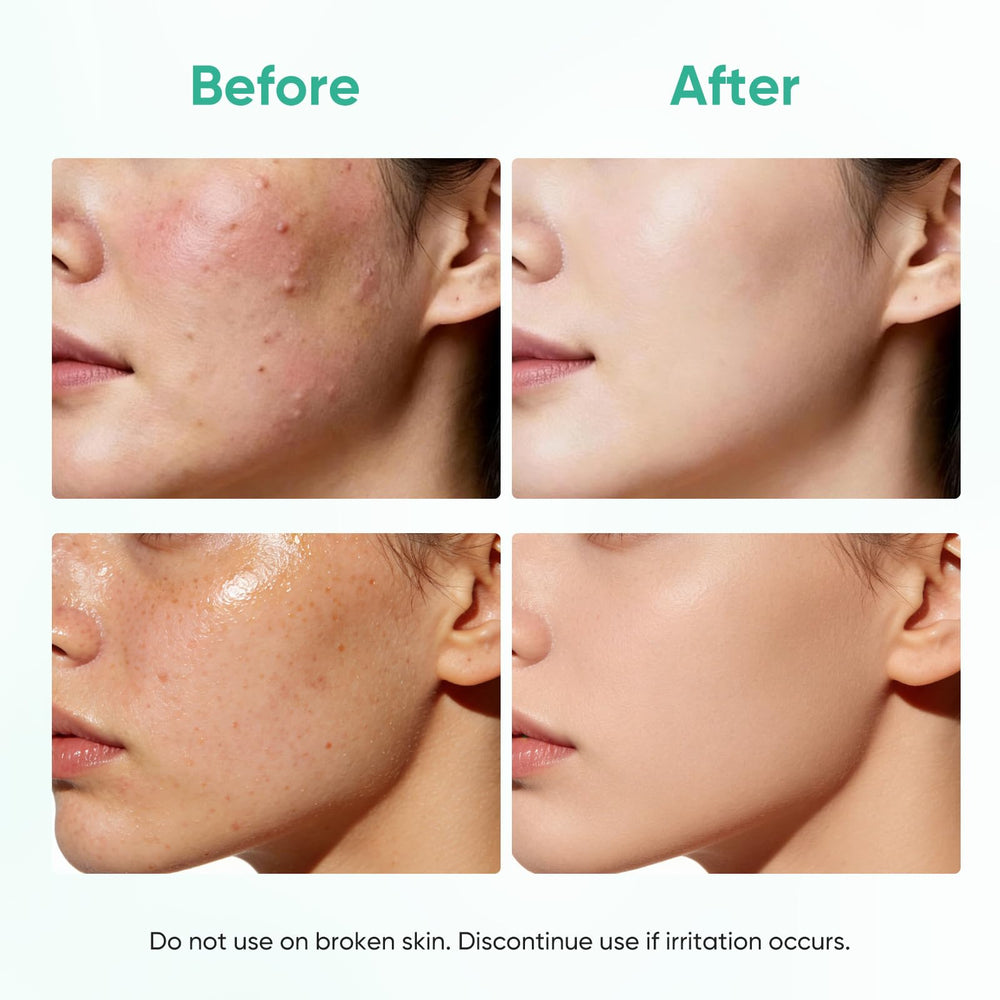 AOPEIBOTO hand holding single mask to show true size and convenience