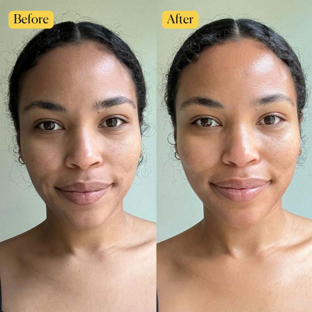APTO dropper releasing golden oil showing quick-absorbing texture