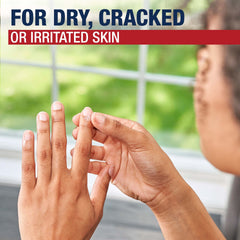 Aquaphor applied to heels demonstrating deep moisturization for rough feet