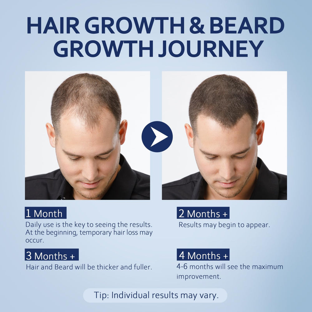 Applying Artimore solution to scalp illustrating targeted coverage and simple twice-daily routine
