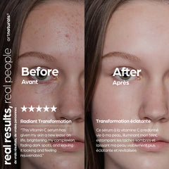 Artnaturals ingredients arranged: jojoba, aloe, hyaluronic acid for soothing hydration