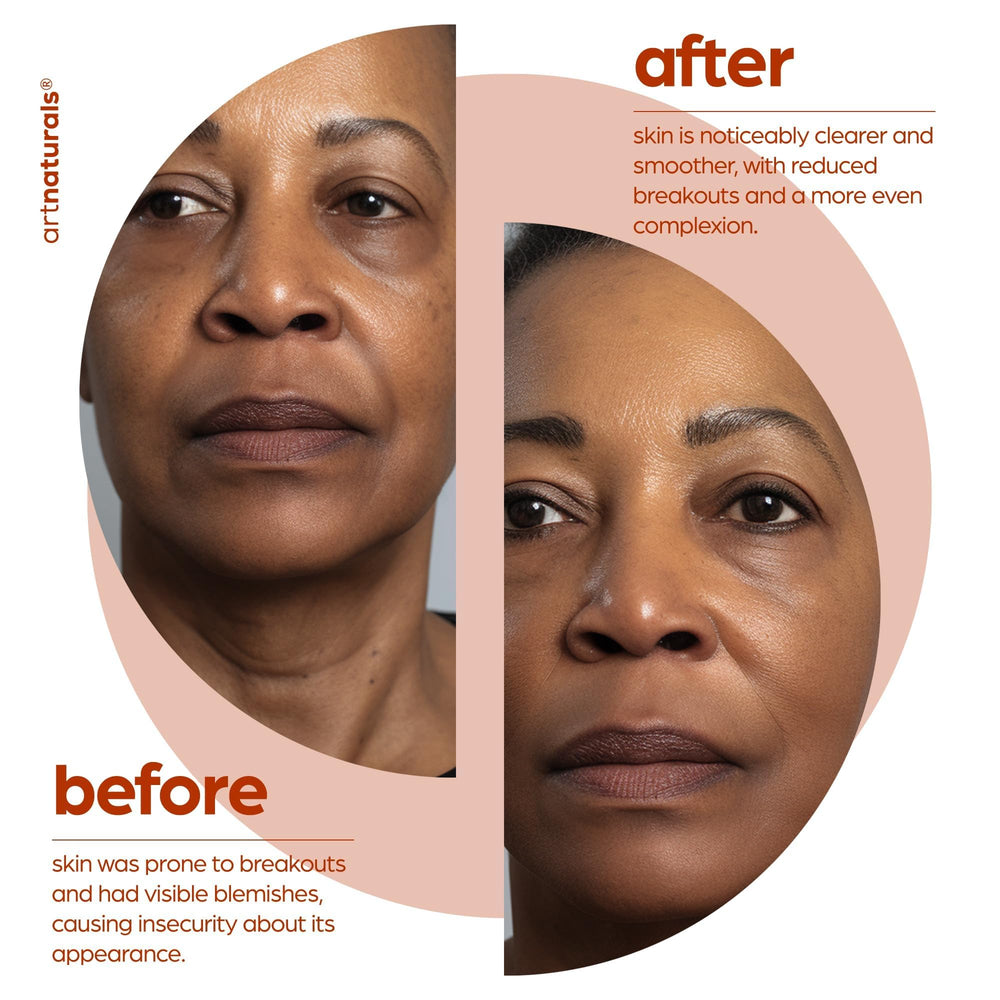 Artnaturals product label with ingredients list showing clean, free-from formulation