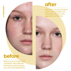 Artnaturals applying serum to cheek showing smoothing and brightening benefit