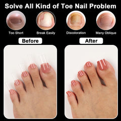 asonrl thin 0.3mm edge detail, natural curvature benefit
