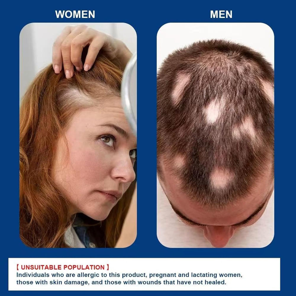 ATHNO applying cream to beard area showing precise application for patchy beard care