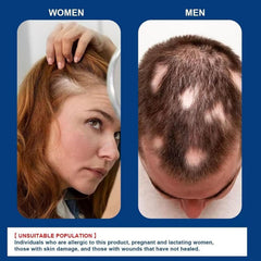 ATHNO applying cream to beard area showing precise application for patchy beard care
