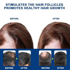 ATHNO ingredient label close-up listing minoxidil, biotin and rosemary for ingredient clarity