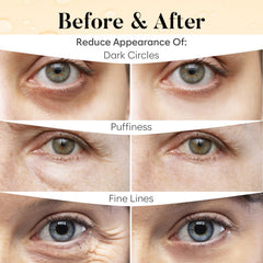 AURAE application under-eye model demonstrating comfortable fit and brightening