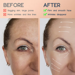 AURUZA tape on neck highlighting firmer-looking contours and targeted lift