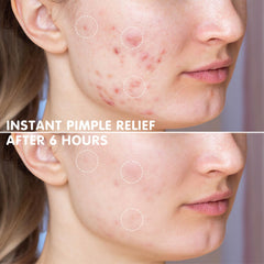 Open AUSLKA compact revealing mirror and neatly stacked star pimple patches