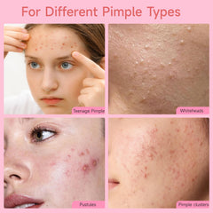 AUSLKA patch applied on cheek offering discreet blemish coverage