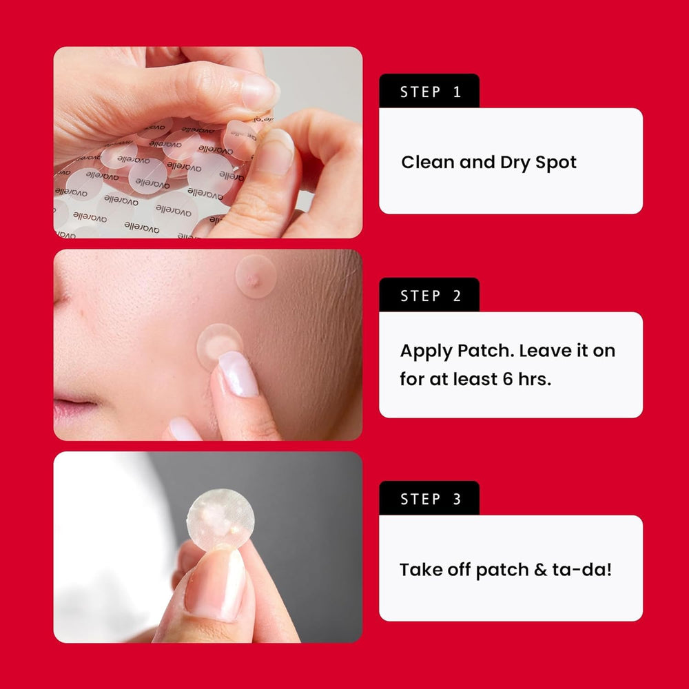AVARELLE assortment of patch sizes laid out for targeted spot treatment benefit