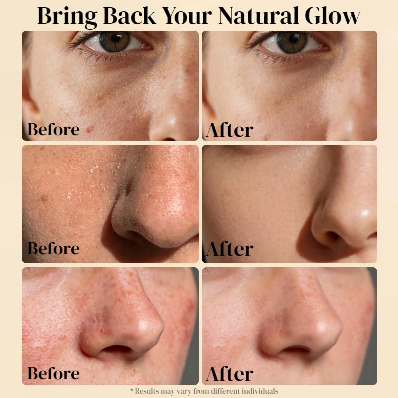 AveCera under-eye application to illustrate gentle use and targeted hydration