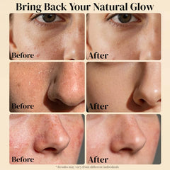 AveCera under-eye application to illustrate gentle use and targeted hydration