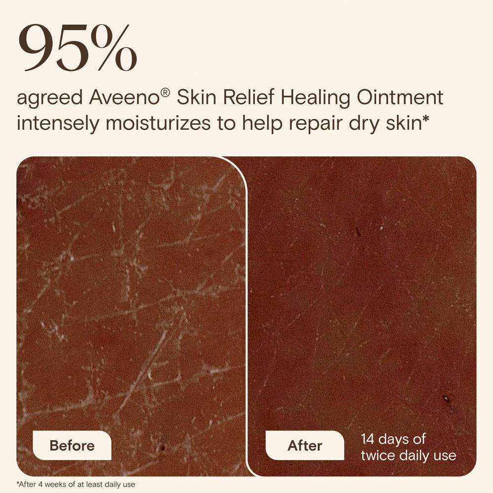 Aveeno ointment applied to lips to relieve chapping and cracking