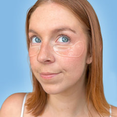 Baebody after treatment under-eye area looking smoother