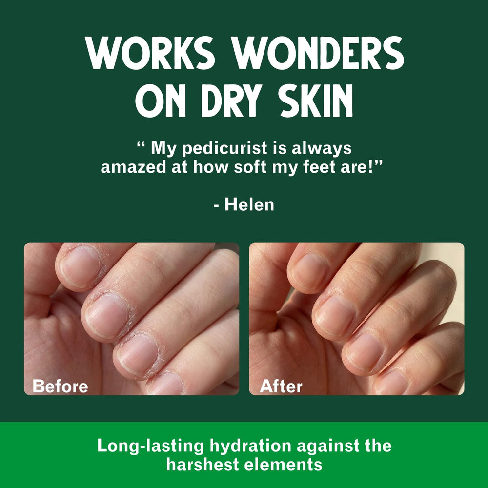 Applying Bag Balm to dry hands for fast relief and long-lasting protection