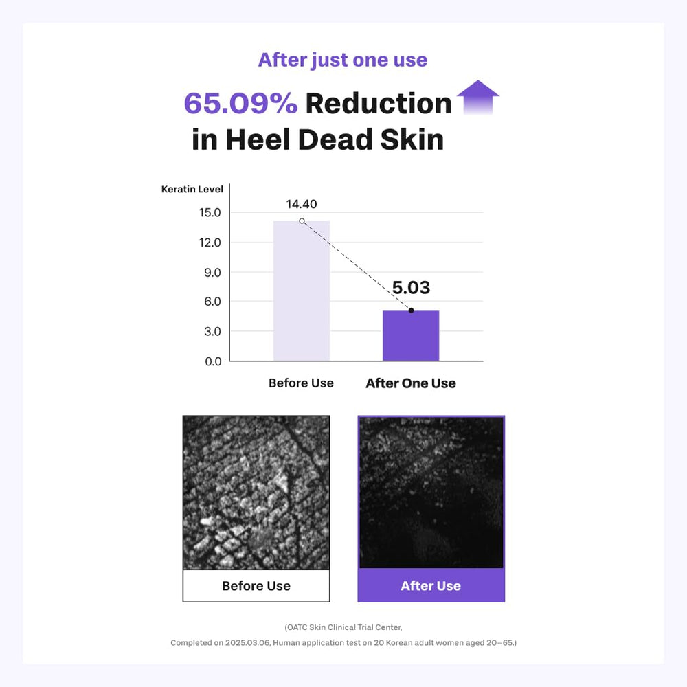 Baren patch on elbow demonstrating versatility and skin softening