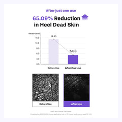 Baren patch on elbow demonstrating versatility and skin softening