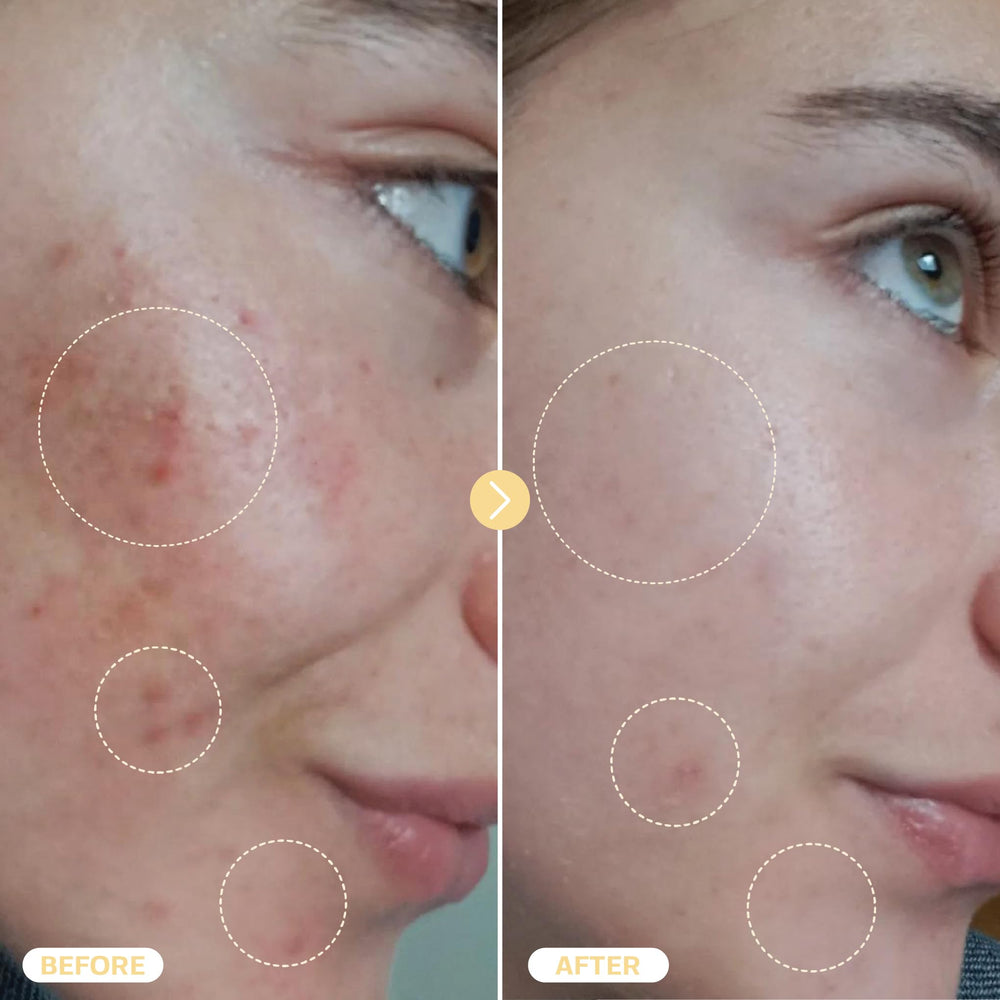 BASE LABORATORIES spray applied to cheek demonstrating calming and refreshing benefit