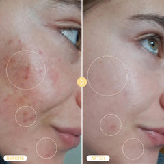 BASE LABORATORIES spray applied to cheek demonstrating calming and refreshing benefit