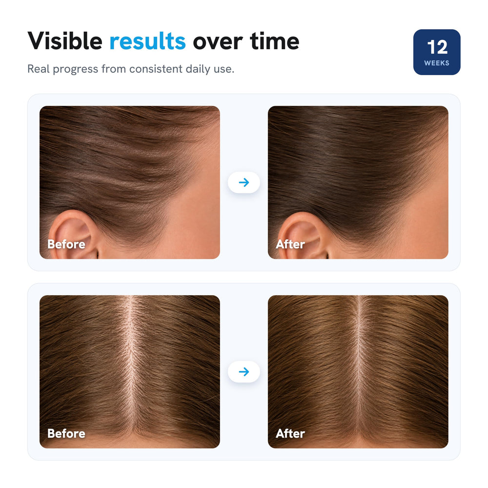 Be Bodywise roll-on held in hand to show scale and easy portable size advantage